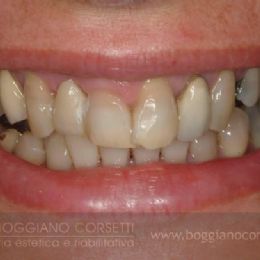 Denti e gengive