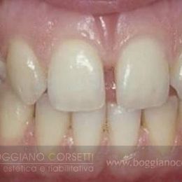 Denti e gengive