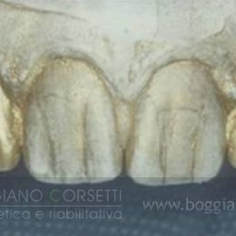 Fase dell'operazione