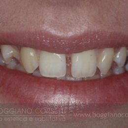 Smile Make Over